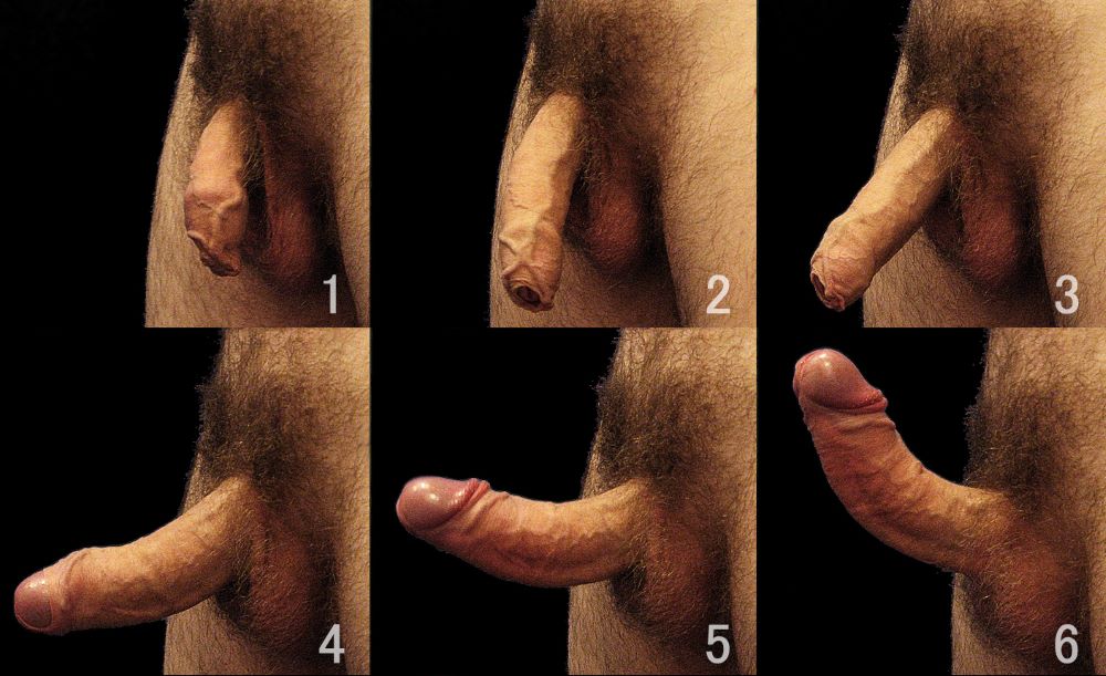 6 images in a collage showing the anatomy of the male penis as it becomes erected. Visual of an un-circumsised penis showing the head and glans in images 4 through 6 as one of the 5 erogenous zones to make him melt.